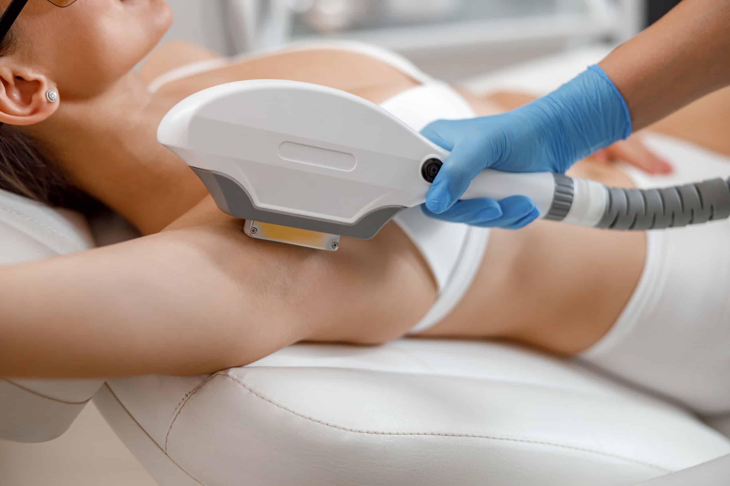 Closeup of armpit hair laser removal procedure with ipl machine in MD Beauty Spa in Scottsdale, AZ
