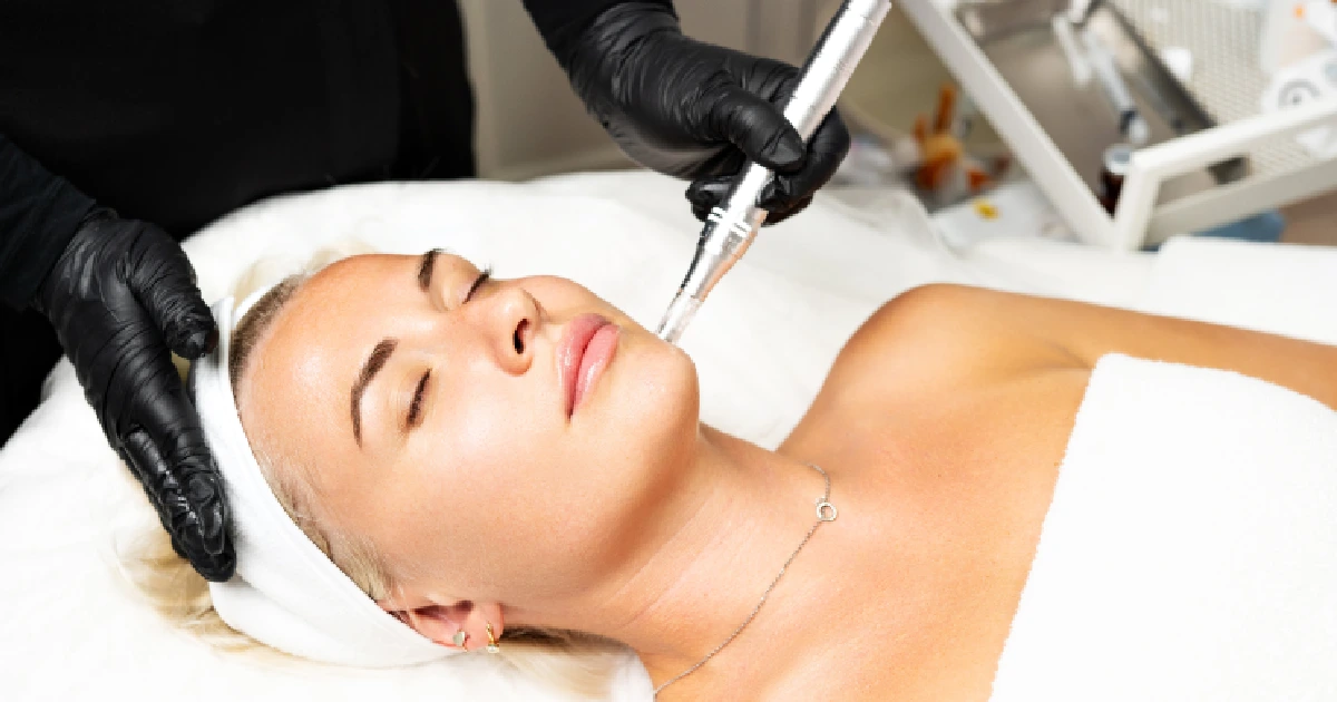 A Women Receiving Microneedling with SkinPen in Scottsdale, AZ